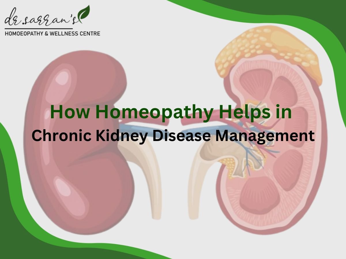 Homeopathy treatment for kidney diseases promoting natural kidney health.