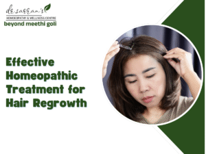Homeopathic Treatment for Hair Regrowth