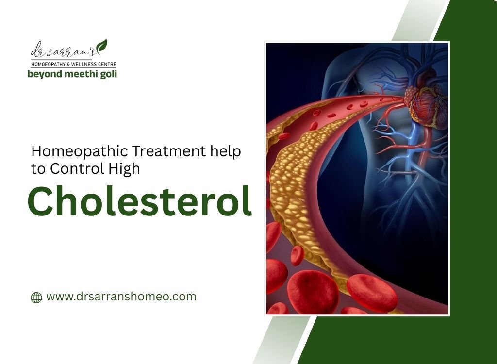 Homeopathic treatment in Mumbai to help manage high cholesterol naturally and support heart health