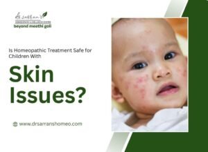 Homeopathic treatment for children with skin issues and natural skin care