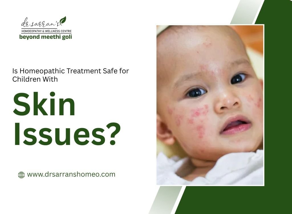 Homeopathic treatment for children with skin issues and natural skin care