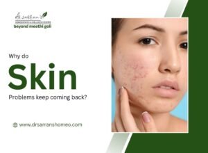 Recurring skin problems like acne, eczema, and rashes explained visually with causes and triggers