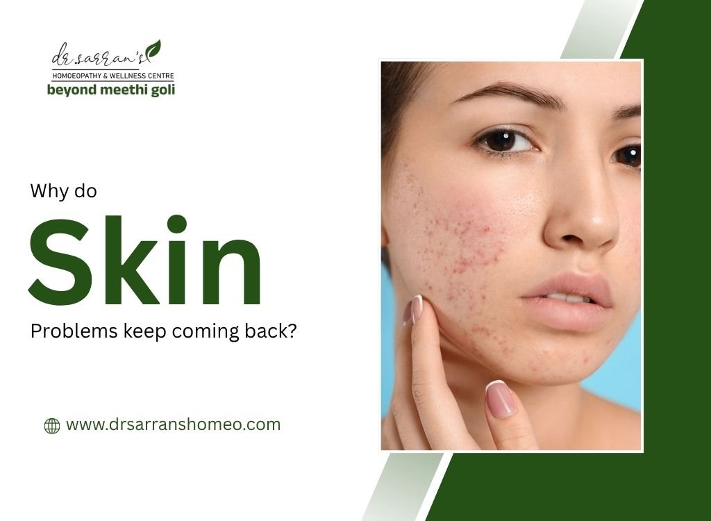 Recurring skin problems like acne, eczema, and rashes explained visually with causes and triggers