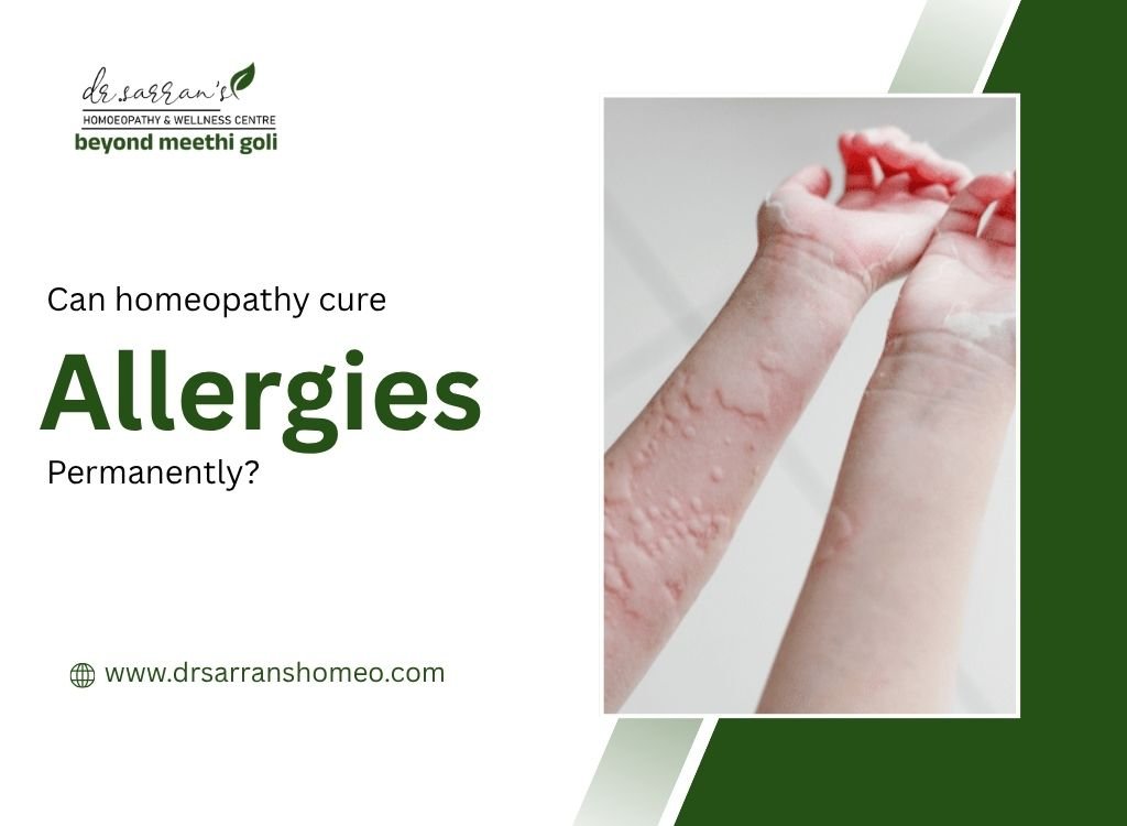 Homeopathy for permanent allergy relief, including pollen, dust, and food allergies