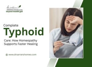 Homeopathic treatment for typhoid to support faster recovery and symptom management naturally