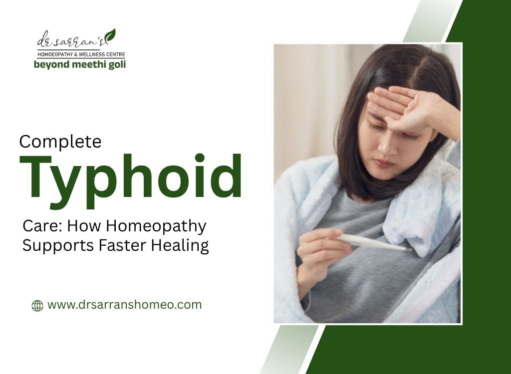 Homeopathic treatment for typhoid to support faster recovery and symptom management naturally