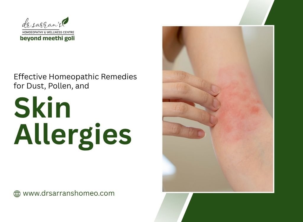 Person experiencing allergy symptoms like sneezing and skin irritation, highlighting natural homeopathic remedies for dust, pollen, and skin allergies.
