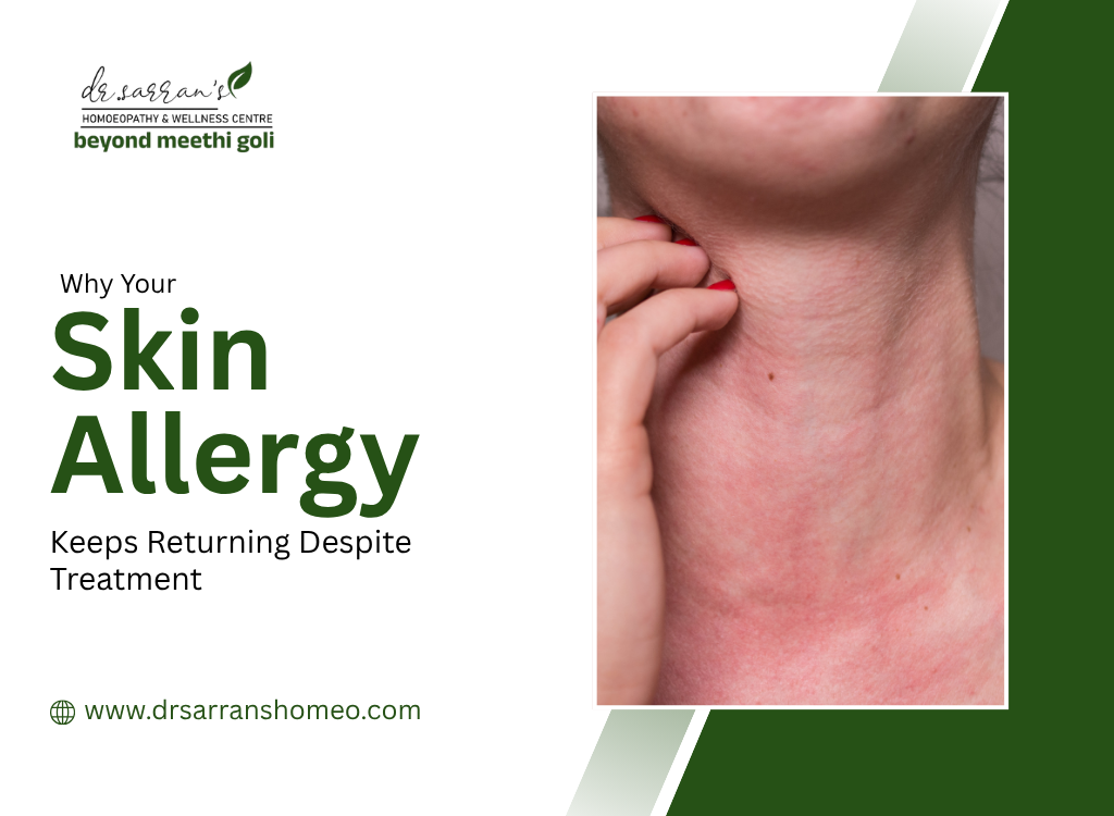 Skin Allergy Keeps Returning Despite Treatment
