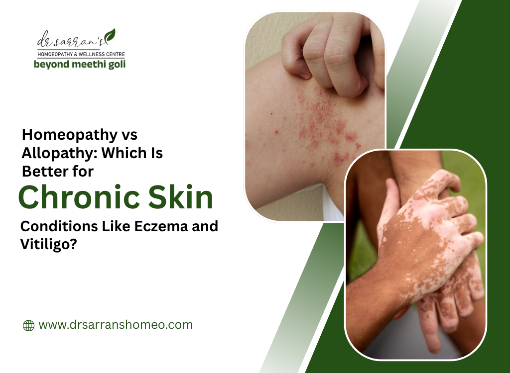 Chronic Skin Conditions Like Eczema and Vitiligo